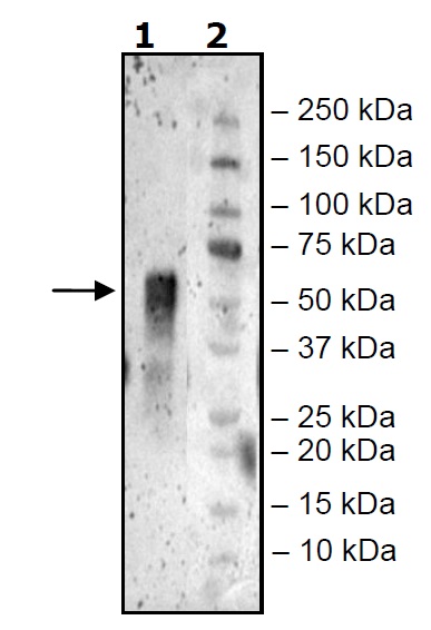 Recombinant Human CD16b protein (Tagged)