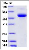SDS-PAGE - Recombinant Human CD177 protein (His tag) (AB276619)