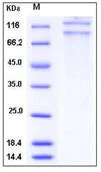 SDS-PAGE - Recombinant Human CD18 + CD11c protein (Tagged) (AB277029)