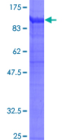 SDS-PAGE - Recombinant Human CD18 protein (AB112311)