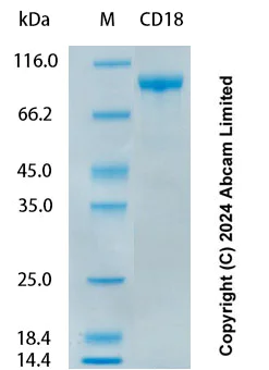 SDS-PAGE - Recombinant Human CD18 Protein Standard (AB323043)