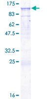 SDS-PAGE - Recombinant Human CD19 protein (AB158046)