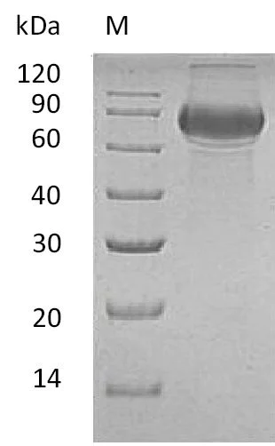 SDS-PAGE - Recombinant human CD19 protein (Active) (AB275937)