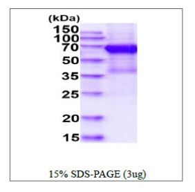 SDS-PAGE - Recombinant Human CD19 protein (Fc tag C-Terminus + His tag C-Terminus) (AB270576)