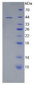SDS-PAGE - Recombinant Human CD19 protein (Tagged) (AB270598)