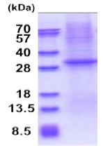 SDS-PAGE - Recombinant Human CD1E protein (denatured) (AB177643), expandable thumbnail