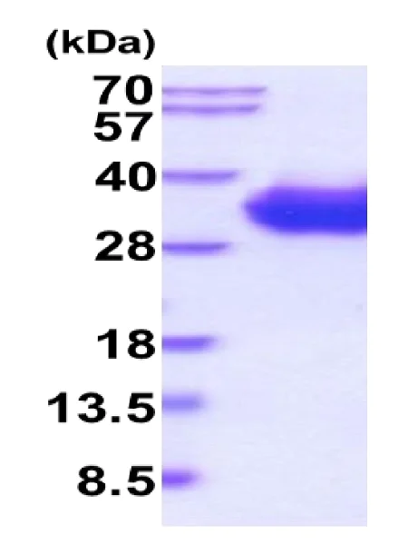 SDS-PAGE - Recombinant Human CD2 protein (His tag C-Terminus) (AB223007)