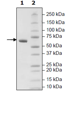 SDS-PAGE - Recombinant Human CD2 protein (Tagged) (AB271411)
