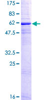 SDS-PAGE - Recombinant Human CD20 protein (GST tag N-Terminus) (AB158047)