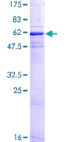 SDS-PAGE - Recombinant Human CD20 protein (AB158047)