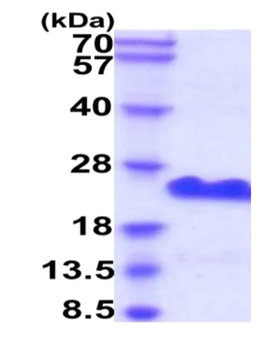 SDS-PAGE - Recombinant Human CD20 protein (His tag) (AB229363)