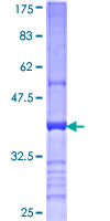 SDS-PAGE - Recombinant Human CD200 / OX2 protein (AB152536)