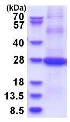 SDS-PAGE - Recombinant Human CD200 / OX2 protein (denatured) (AB181947)
