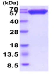 SDS-PAGE - Recombinant Human CD200 / OX2 protein (Fc tag C-Terminus + His tag C-Terminus) (AB219476)