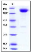 SDS-PAGE - Recombinant human CD200R protein (Fc Chimera His Tag) (AB276371)