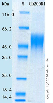 SDS-PAGE - Recombinant Human CD200R Protein Standard (His tag) (AB316573)