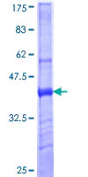 SDS-PAGE - Recombinant Human CD206 protein (GST tag N-Terminus) (AB152538)