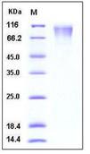 SDS-PAGE - Recombinant Human CD208 protein (His tag) (AB276290)