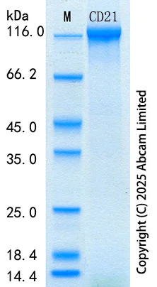 SDS-PAGE - Recombinant Human CD21 Protein Standard (His tag) (AB316716)