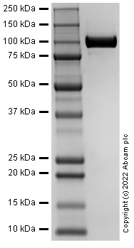 SDS-PAGE - Recombinant Human CD22 protein (AB302449)