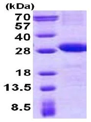 SDS-PAGE - Recombinant Human CD226 protein (denatured) (His tag N-Terminus) (AB140062)