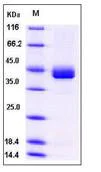 SDS-PAGE - Recombinant Human CD23 protein (His tag) (AB276236)