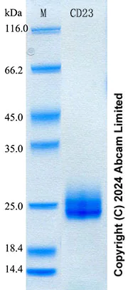 SDS-PAGE - Recombinant Human CD23 Protein Standard (His tag) (AB316558)