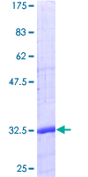 SDS-PAGE - Recombinant Human CD24 protein (AB158052), expandable thumbnail