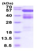 SDS-PAGE - Recombinant human CD27 protein (His tag) (AB219420), expandable thumbnail
