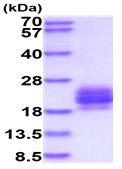 SDS-PAGE - Recombinant Human CD272/BTLA protein (His tag) (AB227411), expandable thumbnail