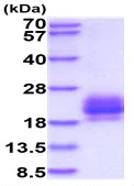 SDS-PAGE - Recombinant Human CD272/BTLA protein (His tag C-Terminus) (AB227411)