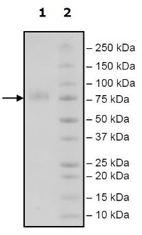 Recombinant Human CD276 protein (Tagged)