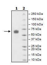 SDS-PAGE - Recombinant Human CD28 protein (AB198634), expandable thumbnail