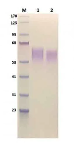SDS-PAGE - Recombinant human CD28 protein (Active) (AB286013)