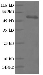 SDS-PAGE - Recombinant Human CD3 epsilon protein (GST Tag) (AB238383)