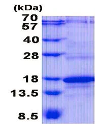 SDS-PAGE - Recombinant Human CD3 zeta protein (His tag N-Terminus) (AB139254)