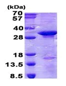 SDS-PAGE - Recombinant Human CD300C protein (denatured) (His tag N-Terminus) (AB139785)