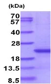 SDS-PAGE - Recombinant Human CD300e protein (denatured) (His tag N-Terminus) (AB187433)