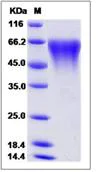 SDS-PAGE - Recombinant Human CD300LG protein (His tag) (AB276532)