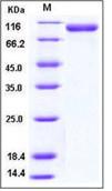 SDS-PAGE - Recombinant Human CD31 protein (His tag) (AB276210)