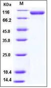 SDS-PAGE - Recombinant Human CD31 protein (His tag) (AB276210)