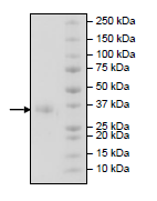 Recombinant Human CD32A protein (His tag)