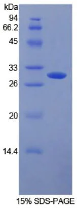 SDS-PAGE - Recombinant Human CD32A protein (Tagged) (AB270596)