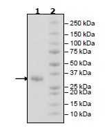Recombinant Human CD32B protein (Tagged)