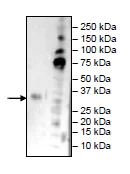 Western blot - Recombinant Human CD32B protein (Tagged) (AB269989)