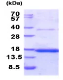 SDS-PAGE - Recombinant Human CD37 protein (denatured) (His tag N-Terminus) (AB187610)