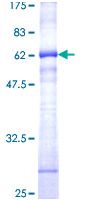 SDS-PAGE - Recombinant Human CD38 protein (AB114253)