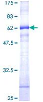 SDS-PAGE - Recombinant Human CD38 protein (GST tag N-Terminus) (AB114253)