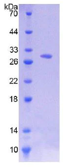 SDS-PAGE - Recombinant Human CD38 protein (His tag) (AB270589)