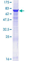 SDS-PAGE - Recombinant Human CD39 protein (AB114445), expandable thumbnail